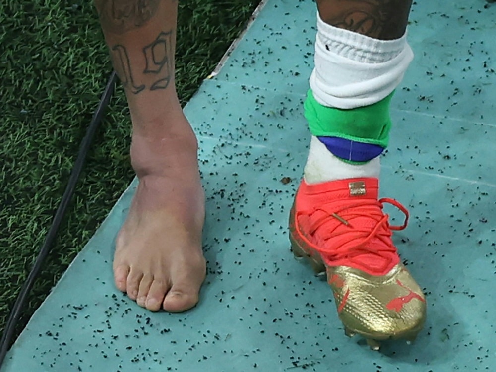 Brasiliens Star Neymar erlitt eine Knöchelverletzung (© AFP/SID/GIUSEPPE CACACE)